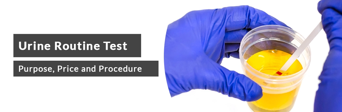 Urine Routine Test: Purpose, Price and Procedure